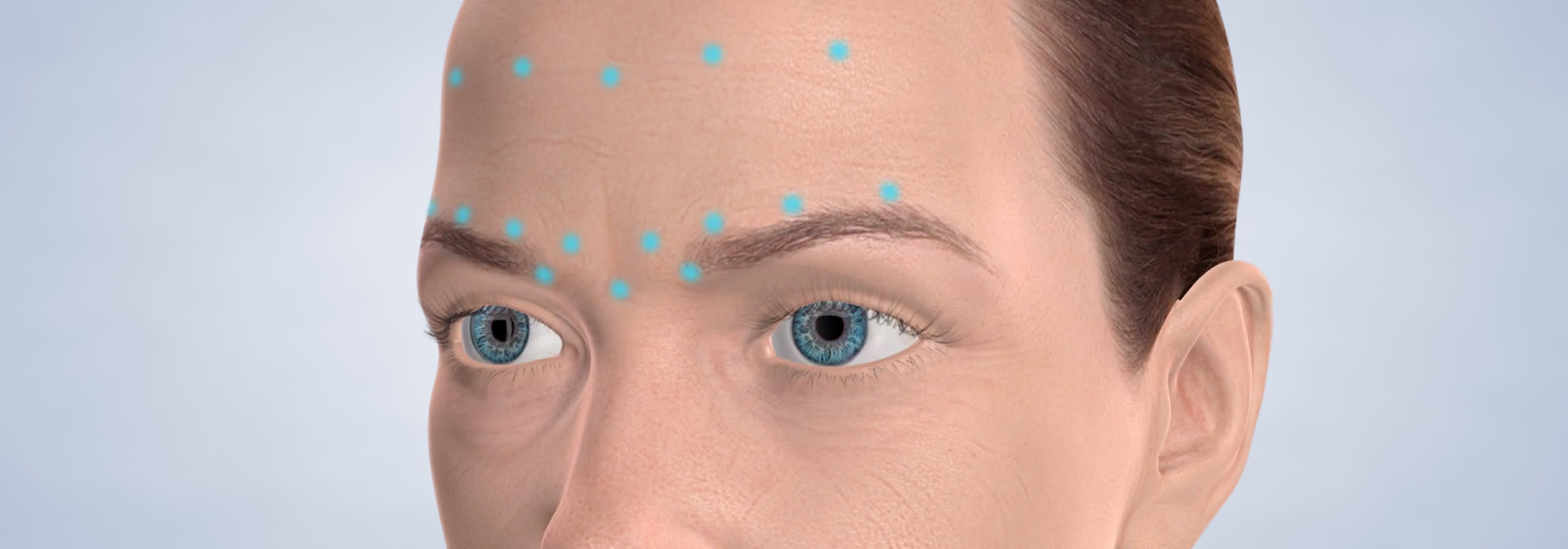 Botox procedure desktop