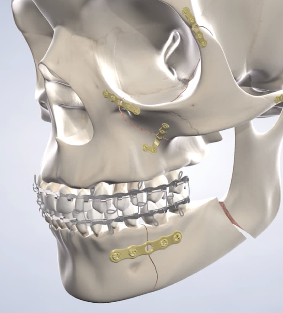 Facial trauma procedure query page